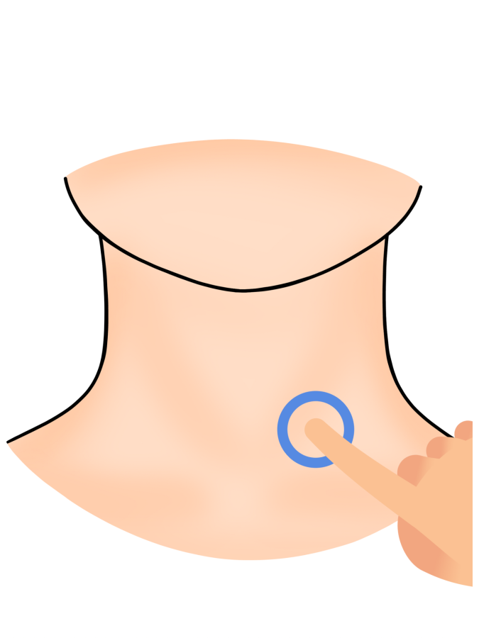 星狀神經節注射