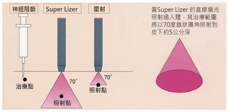 近紅外線照射更深更廣