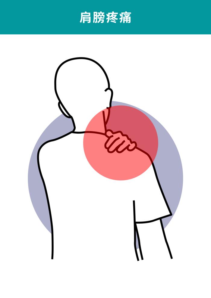 肩膀痛,五十肩,肌筋膜疼痛,手舉不起來
