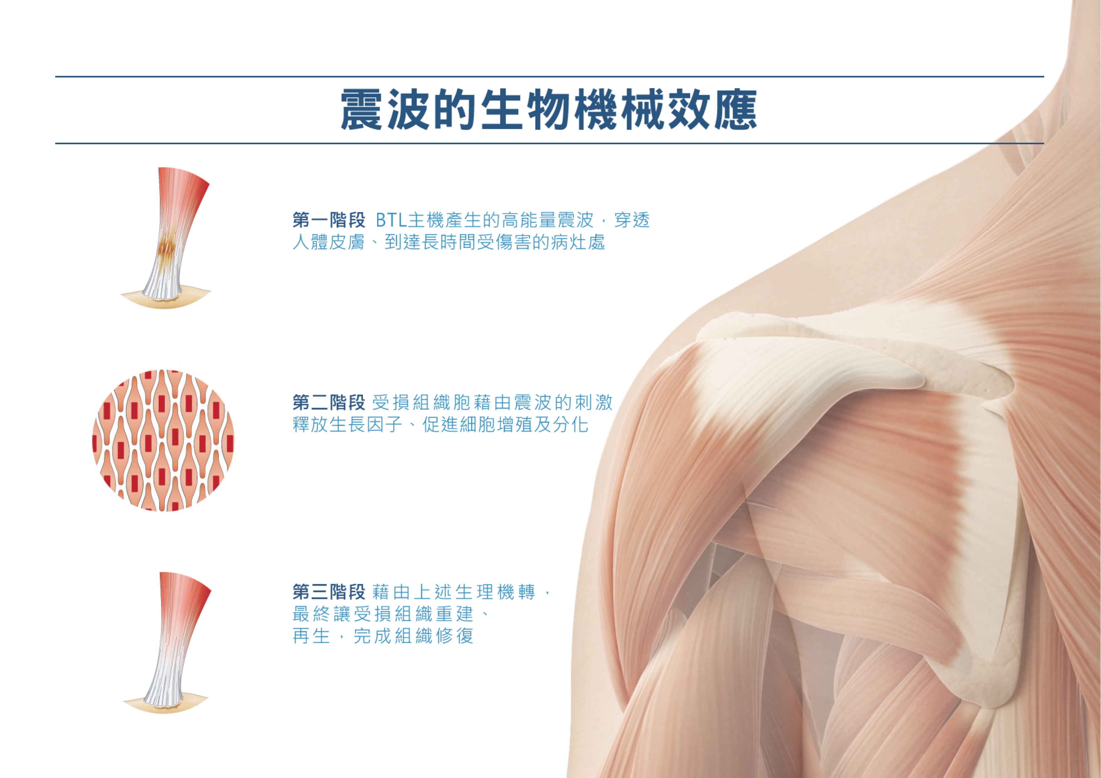 足底筋膜炎,滑囊炎,肩頸疼痛,五十肩,下背痛,膝關節退化,肌筋膜疼痛症候,鈣化性肌腱炎,足跟骨刺,肩關節鈣化,骨折癒合 足底筋膜炎,滑囊炎,肩頸疼痛,五十肩,下背痛,膝關節退化,肌筋膜疼痛症候,鈣化性肌腱炎,足跟骨刺,肩關節鈣化,骨折癒合