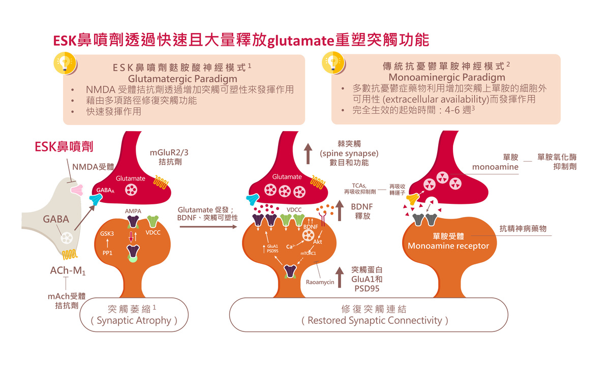 憂鬱症,重鬱症,微笑憂鬱症,Esketamine,速開朗 憂鬱症,重鬱症,微笑憂鬱症,Esketamine,速開朗